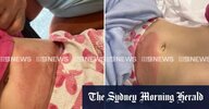 ezra-mam-crash-left-girl-with-broken-hip-seatbelt-burns-v0-dZRLlumoSLHXZtWVSxaWsJqUdDghWFhro5Y...jpg